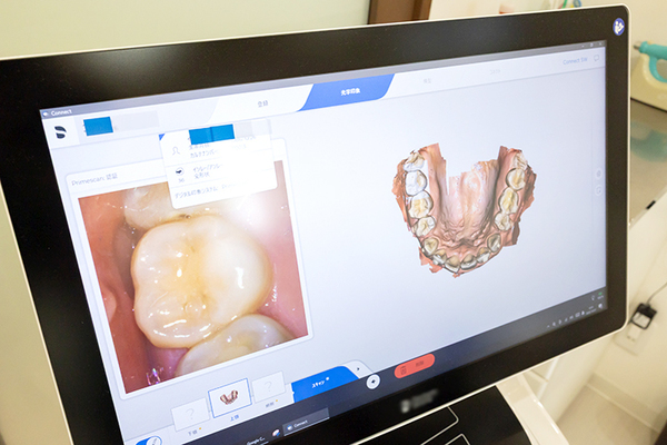 いしはら総合歯科 口内の様子が360度わかる3D口腔内スキャナー