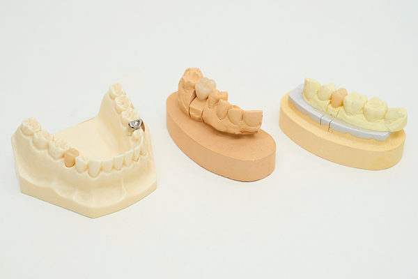 クレール歯科クリニック 審美面・機能面ともに質の高い治療に注力している