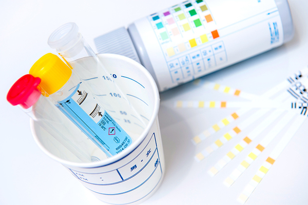 北千住セブンデイズクリニック 排尿時の痛みや排膿により病気が疑われる場合は尿検査を実施