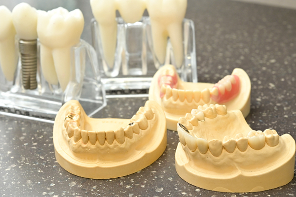 あいあーる歯科目黒駅医院 歯髄が壊死すれば、根管治療をし、失った歯を補う必要が出てくる