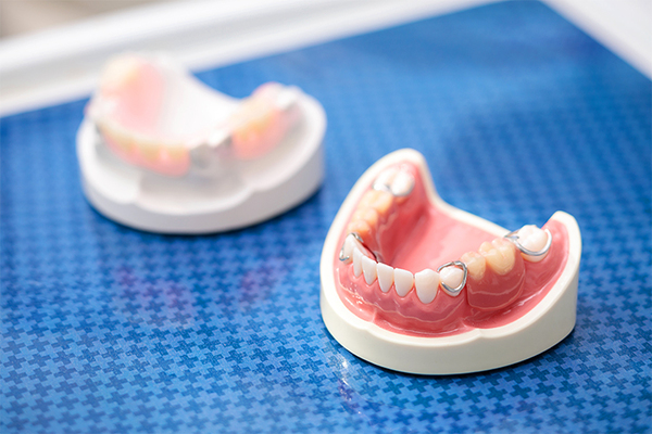 青山クオーツデンタルクリニック 虫歯や歯周病のリスクもある