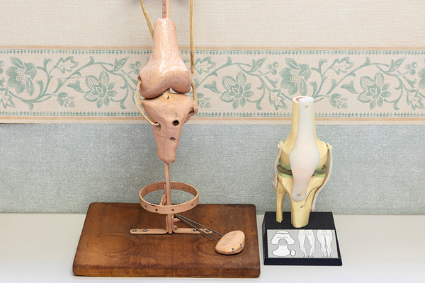 善紀クリニック 画像左は、研究の原点となった山地院長自作の膝標本だ