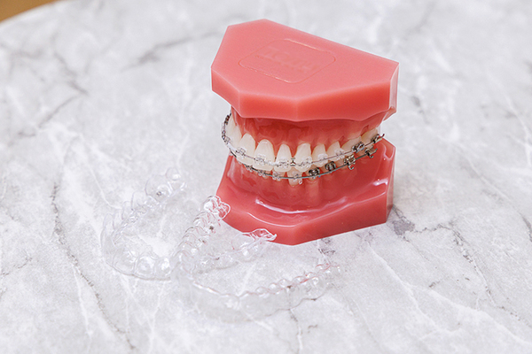 天神AN矯正歯科 さまざまな種類の歯科矯正方法に対応