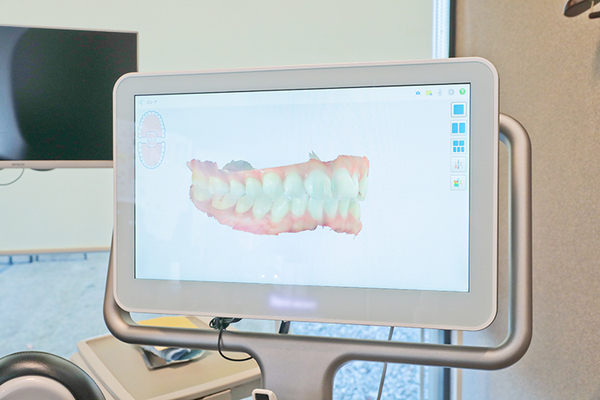 ブリストデンタルクリニック三郷 診療精度を高めるために、レントゲンや口腔内スキャナーを導入