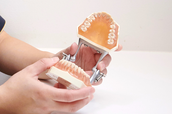 井上歯科医院 どの方法もメリット・デメリットをしっかり理解して選択したい