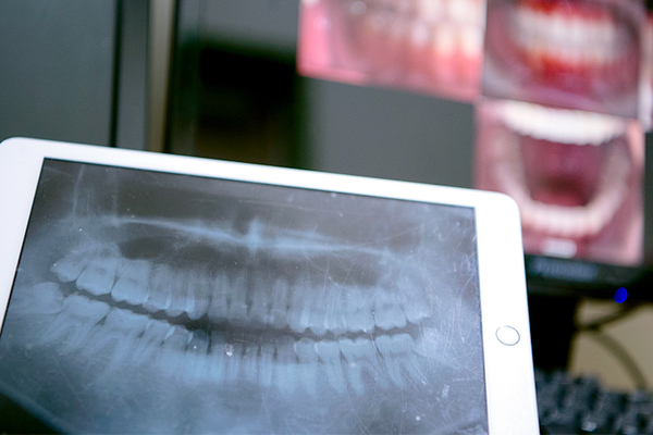 エスト歯科イオンスタイルせんげん台 治療前後の検査も充実している