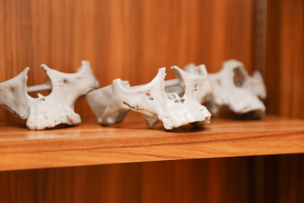 井上秀人歯科インプラントクリニック 上顎の状態を3D出力して説明に用いることも