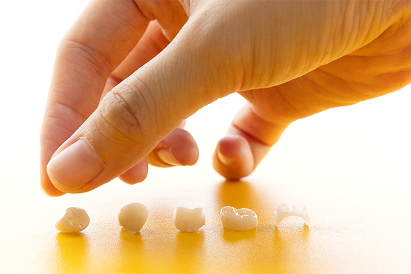 東京神楽坂歯科 機能面も見た目の美しさも追求した詰め物・かぶせ物の治療を提供