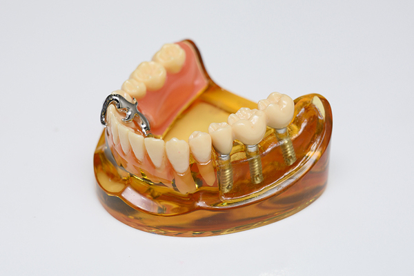 田中歯科医院 よく噛み、唾液をしっかり出すことが健康維持の鍵