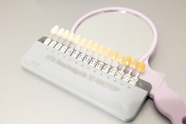 はこざきデンタルクリニック 患者が希望する白さのイメージを聞き、一緒にゴールを決めていく