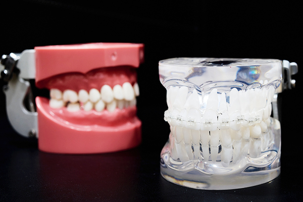 Mori Dental Clinic 目立ちにくい矯正方法も