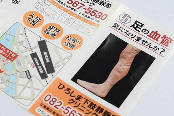 ひろしま下肢静脈瘤クリニック 資料などを用いて丁寧に説明してくれる