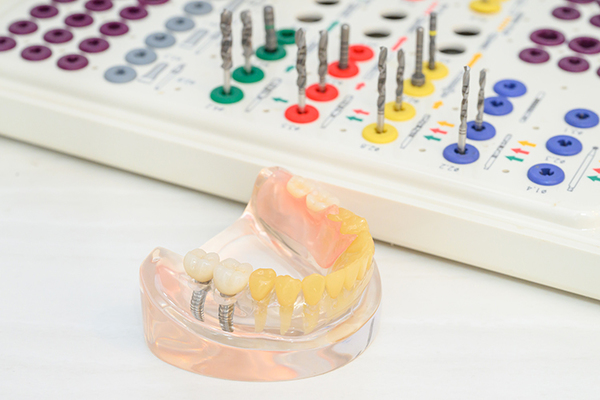 芦屋浜歯科クリニック 器具を用いて患者がわかりやすい説明を心がけている