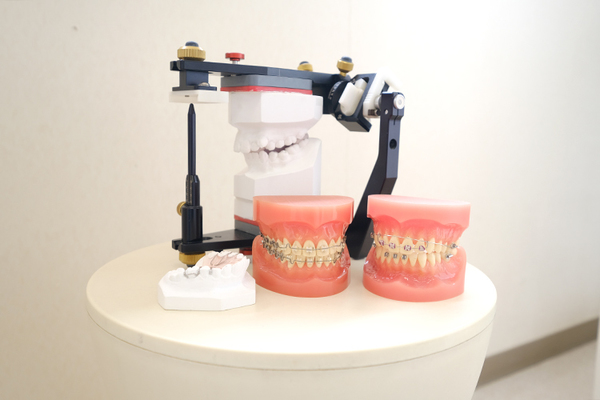 せきや歯科クリニック 入れ歯作製の際、細部にまでこだわる