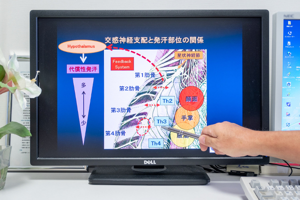 おだクリニック日帰り手術外科 交感神経支配と発汗部位の関係について説明