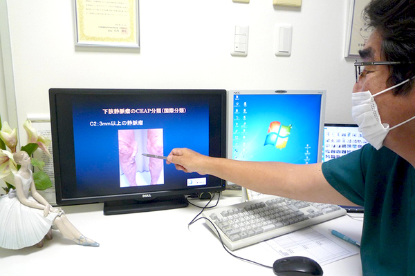 おだクリニック日帰り手術外科 足の血管が数珠状に膨らむ