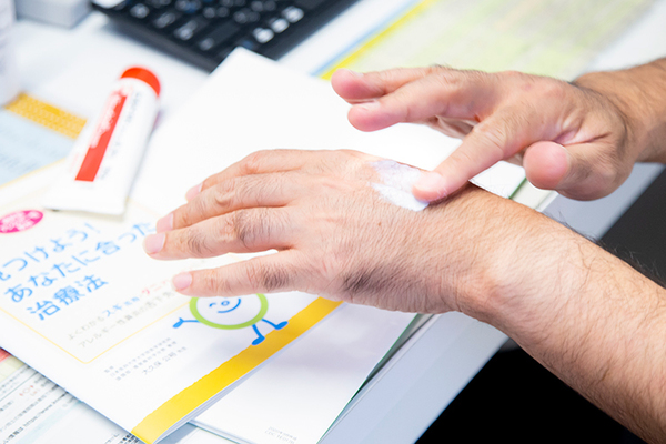 うえだ内科ファミリークリニック レクチャーも交えて、適切なスキンケアや軟こうの塗り方を指導