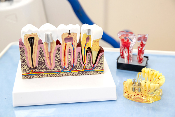 のぶもと歯科 良い素材を選ぶことで将来の口腔環境を整える