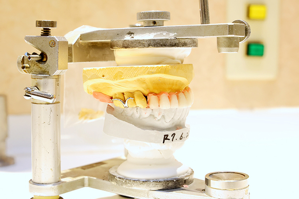 豊田歯科医院 食いしばり対策として、定期的な運動も推奨される