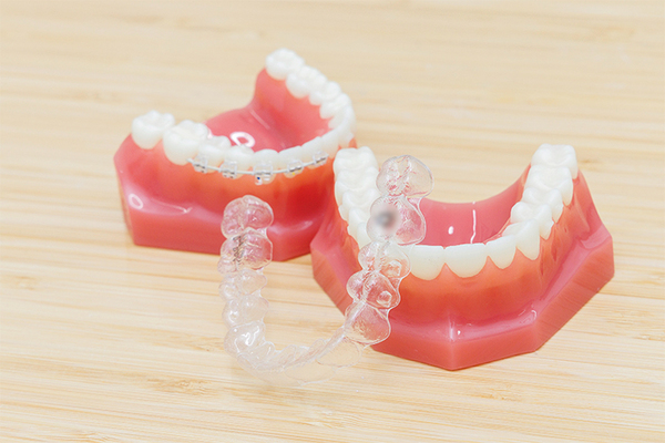 志賀本通たくみ歯科・矯正歯科 取り外し式の装置やマウスピース型装置など矯正方法が充実