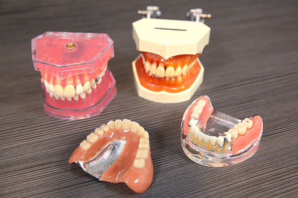 松岡歯科・矯正歯科 骨が少なくなっているケースでも骨造成の処置が可能