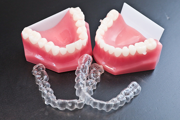 ブリストデンタルクリニック三郷 リスクや選択肢についても具体的な説明を行う