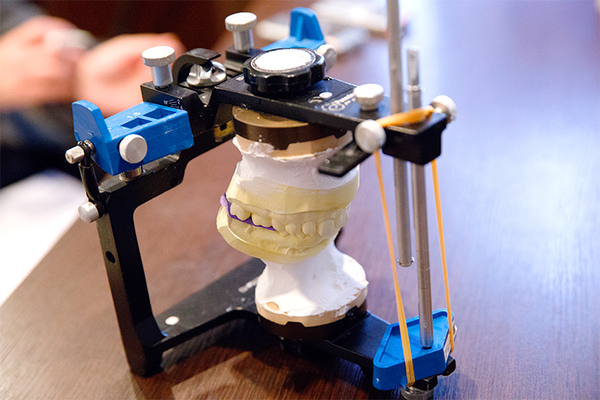 デンタルクリニック アレーズ銀座 噛み合わせの模型を作製し、歯列の調整も行う