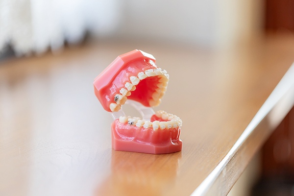 有坂歯科・インプラントオフィス 歯列矯正は見た目だけでなく生涯の健康維持にも貢献