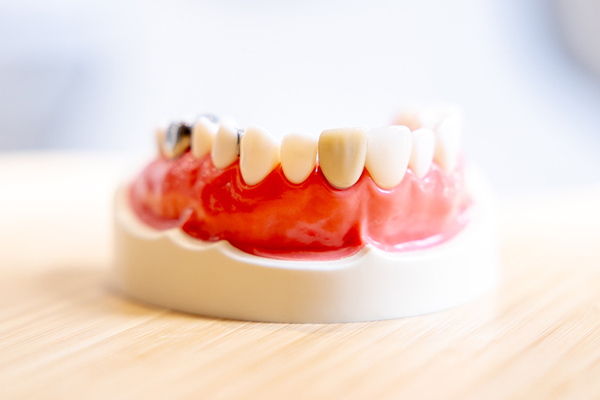 たずみデンタルクリニック 審美だけでなく機能性にも着目し、治療計画を立てていく