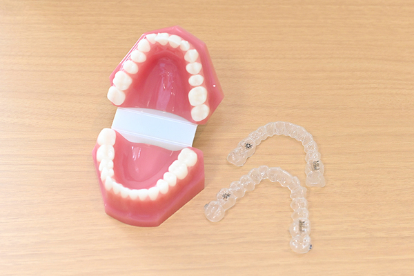 幸田歯科医院 目立ちにくい、マウスピース型装置を用いた歯列矯正