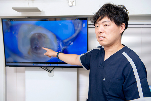 マリコ歯科クリニック 根管治療は技術力や治療の精度によって再発率が高くなる可能性も