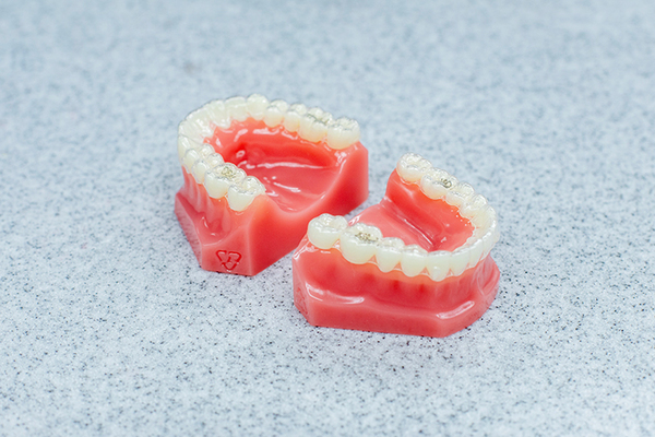 泉本歯科 装着時間を守れるよう習慣化していくことが大切