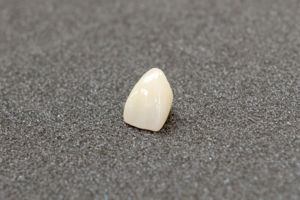 なのはな歯科医院 自費治療のかぶせ物や義歯などは、メリットを含め丁寧に説明