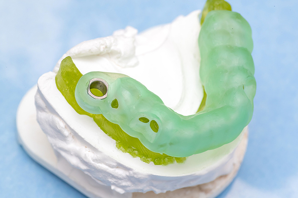 のぶもと歯科 ガイドシステムを用いて、安全で正確なインプラント治療をめざす