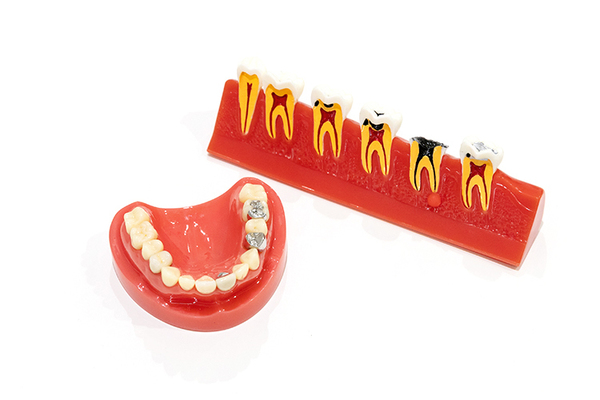 ないとうファミリー歯科クリニック インプラントは天然歯と変わらない噛み心地を感じられる