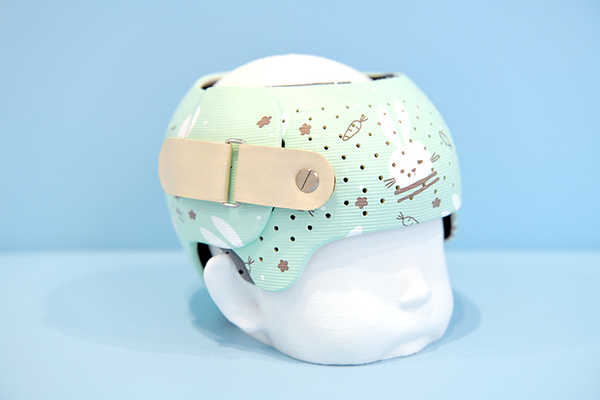 アクアキッズクリニック東池袋院 ヘルメットを用いた治療は早めの治療が重要