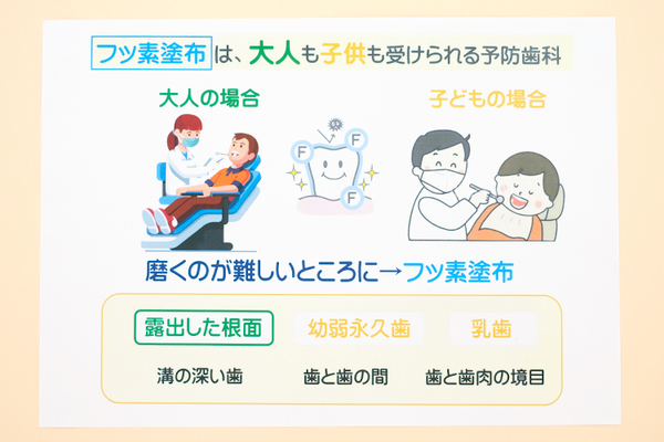 おちあい歯科 フッ素の塗布が歯科医院に慣れていくきっかけに