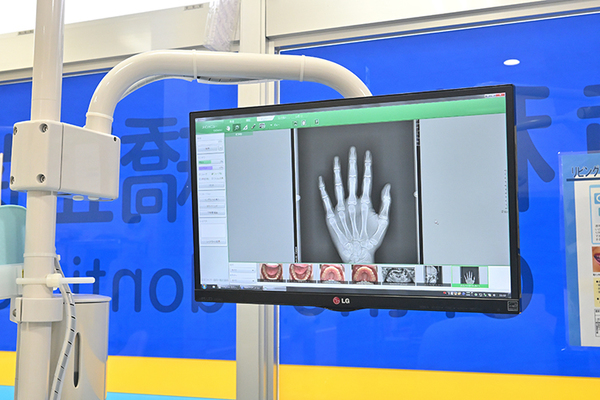 荏田ファミリー歯科・矯正歯科 小児の場合は正しい成長具合を見るため、手のレントゲンを撮影
