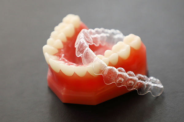 山林歯科医院 目立ちにくく、口腔内を清潔に保ちやすいマウスピース型装置