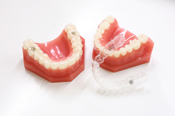 みょうでんfamily歯科 わかりやすいように模型を用いて説明することも