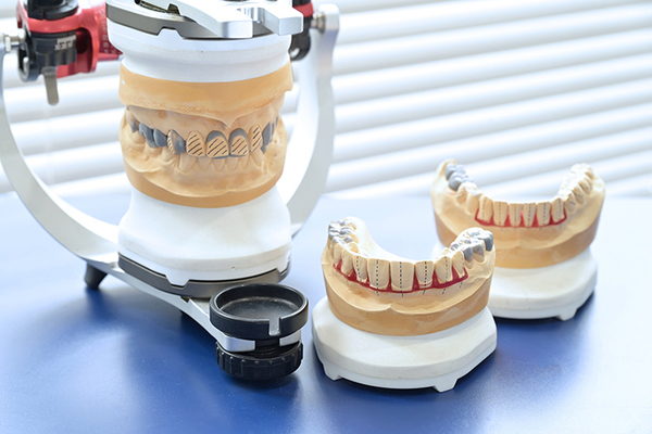 ナカニシデンタルオフィス デジタルとアナログの両面から情報を収集し、治療計画を立てる