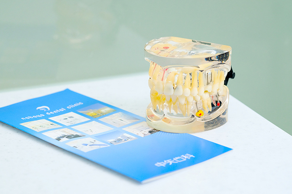 中矢歯科 家で毎日の歯磨きがとても大切