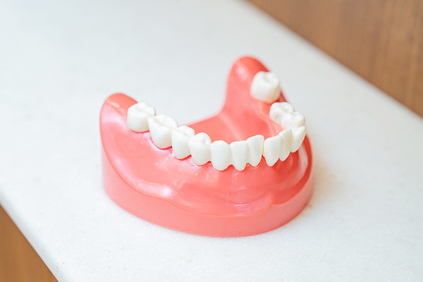 たけはら歯科医院 疑問を不安を解消してから治療に入ることが重要