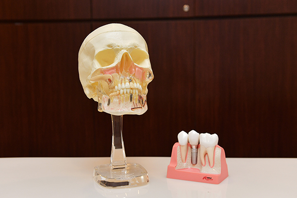 澤歯科 インプラントなどは模型を使ってわかりやすく説明