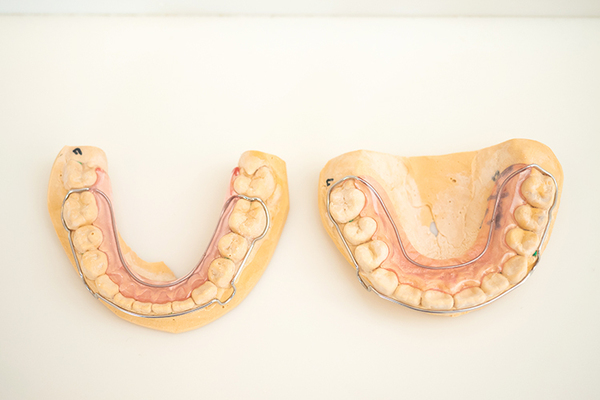 太紀デンタルクリニック リテーナー（保定装置）。左：下顎、右：上顎