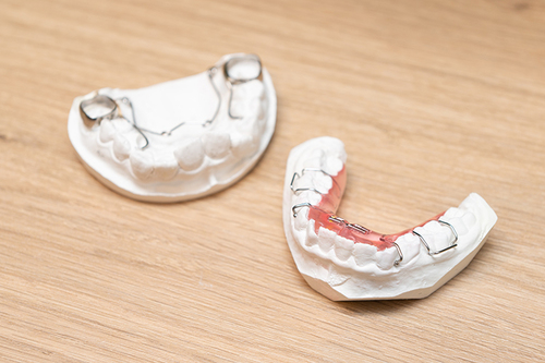 あなたもスーパ矯正ドクター 垂直的思考による矯正治療のすすめ 夢じゃない! 無理じゃない! あなたもスーパー矯正ドクター垂直的