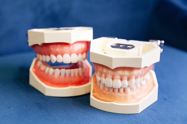 新宿駅前サイナス歯科・矯正歯科 歯周病治療で大切なのは 菌と力のコントロール