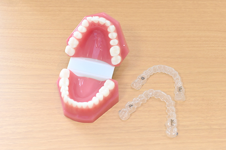 幸田歯科医院 小児でも成人でも始められる マウスピース型装置を用いた矯正