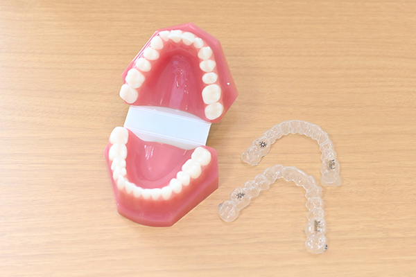 幸田歯科医院 小児でも成人でも始められる マウスピース型装置を用いた矯正