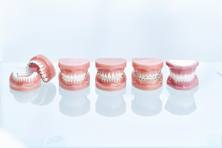 武蔵小杉矯正歯科 専門家に聞く「年代別の歯の矯正」 小児の矯正は慌てずに